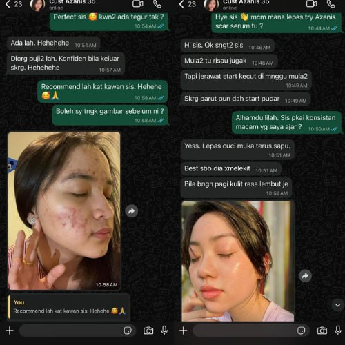 Masalah Parut Jerawat Dalam minggu pertama parut jerawat dah start hilang — Texture serum best. Bangun tidur kulit rasa lembut je — Kawan2 semua tegur kulit dah makin smooth dan clear.