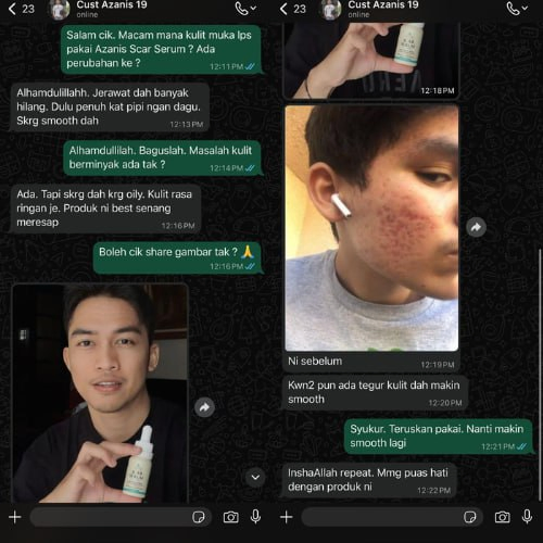 Masalah Parut Jerawat, Kulit muka sekarang rasa dah makin Smooth — Parut Jerawat dah banyak Hilang — Minyak dimuka dah berkurang dan kulit rasa ringan je.