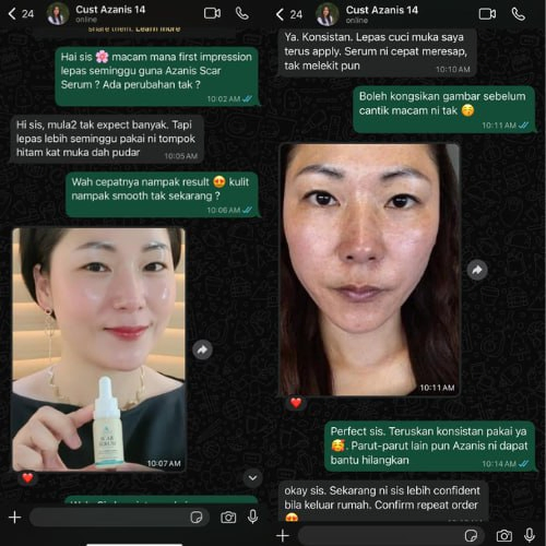 Masalah Bintik Hitam Seminggu lebih je pakai tompok hitam dah start pudar — Serum cepat meresap dan tak melekit — Confirm repeat order